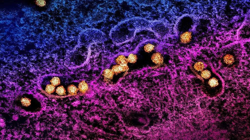 West Nile Virus Claims First Victim in Placer County: How Safe Are You?