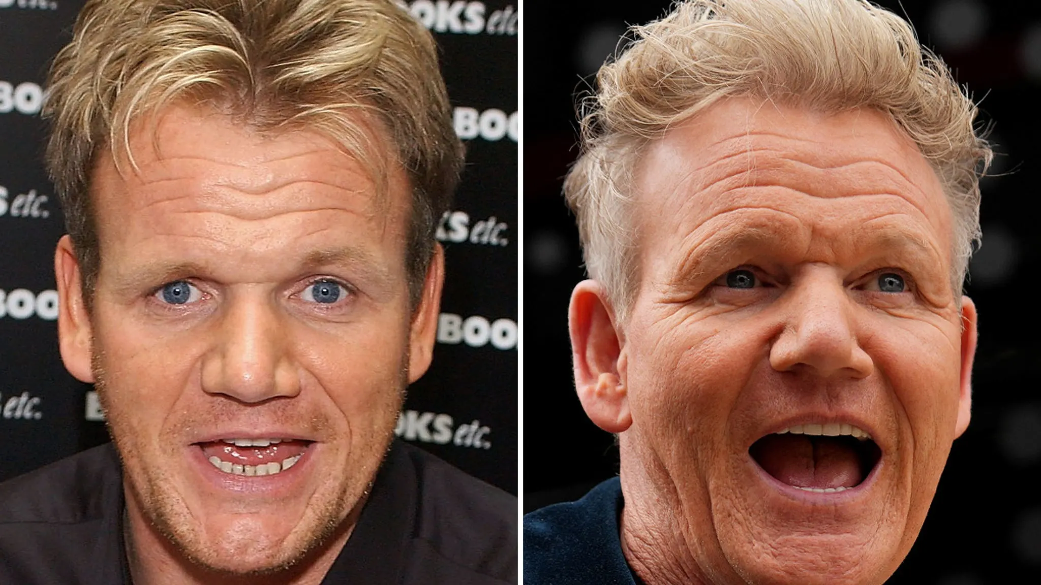 Gordon Ramsay: Aging Like Fine Wine or Just Really Good Doctors?