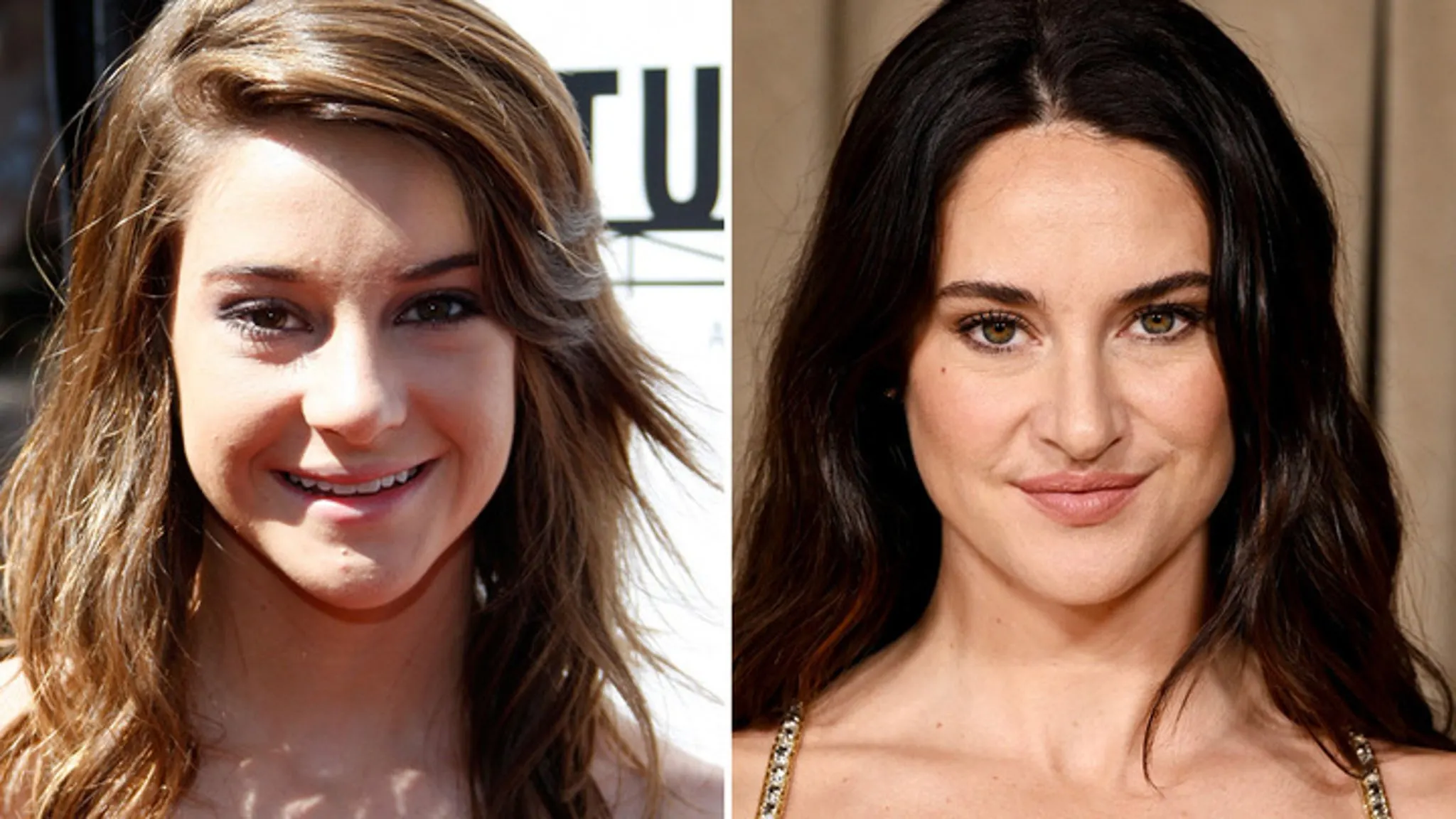 Shailene Woodley's Ageless Beauty: Good Genes or Good Docs? You Decide!