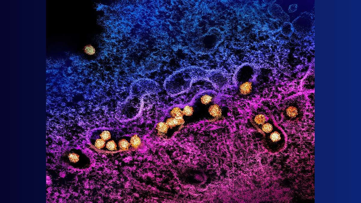 West Nile Virus Claims First Victim in Placer County: How Safe Are You?