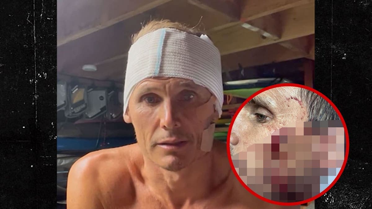 Surfer’s Wipeout: When Riding Waves Turns into a Bloody Nightmare