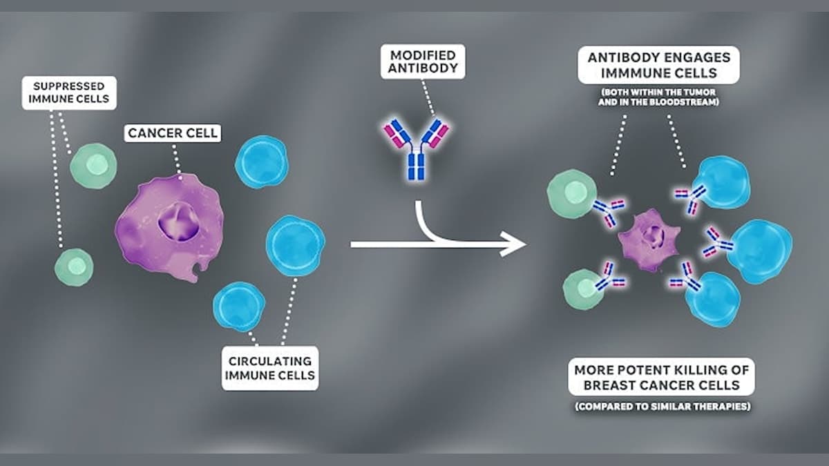 New Antibody Breakthrough Could Turn the Tide Against Treatment-Resistant Breast Cancer!