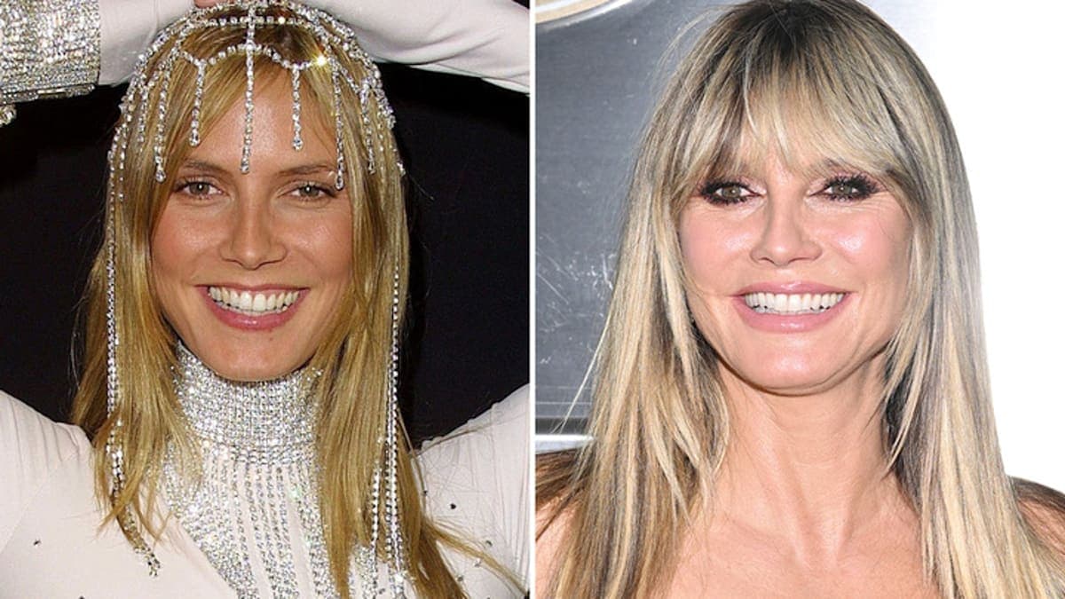Heidi Klum: Good Genes or Good Docs? The Halloween Queen Spills Her Secrets!
