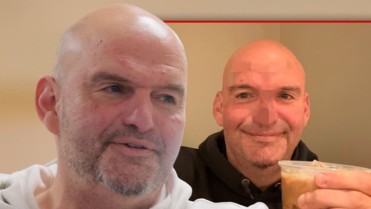 Senator John Fetterman's Stitches: A Fall, A Selfie, and a Smile