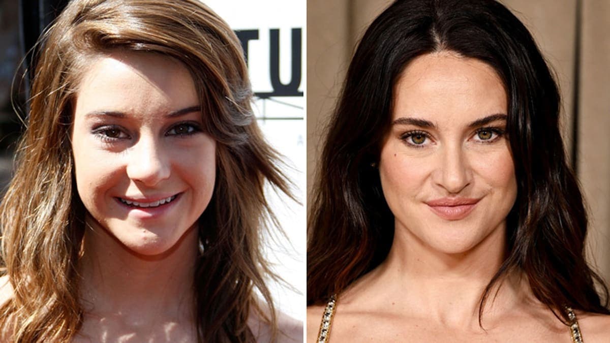 Shailene Woodley's Ageless Beauty: Good Genes or Good Docs? You Decide!
