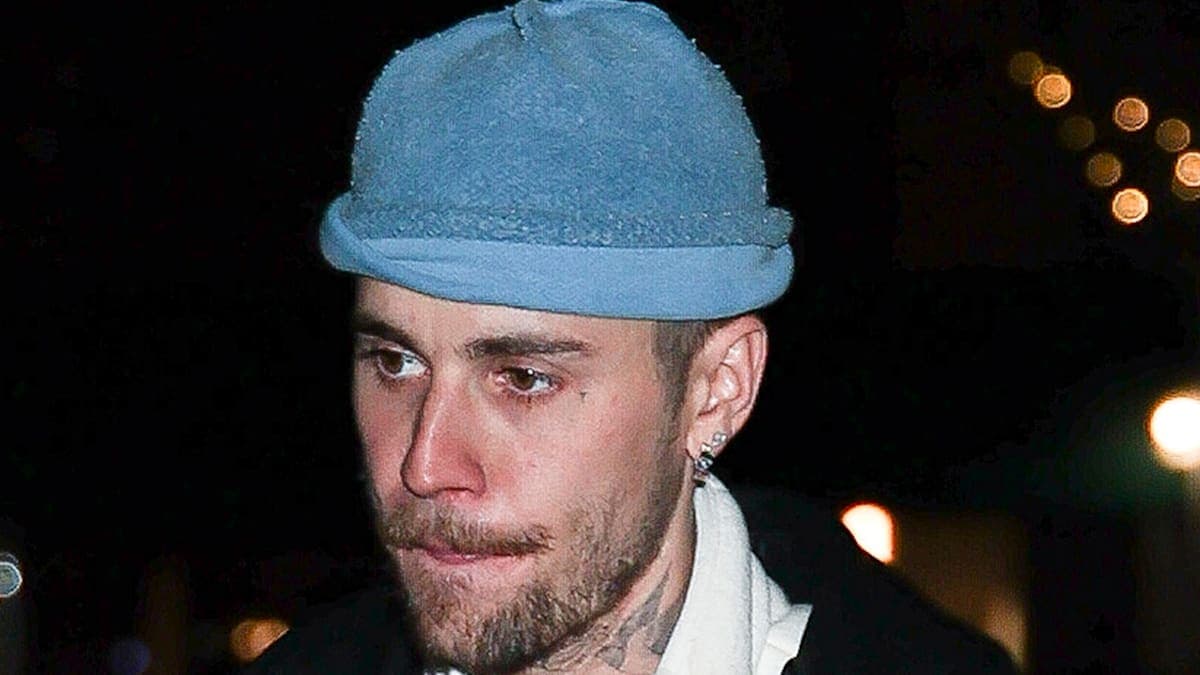 Skateboard Wipeout: Justin Bieber’s Painful Spill on the Electric Ride