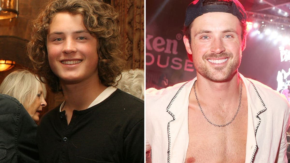 Dylan Efron: Good Genes or Good Docs? The Shocking Truth Revealed!