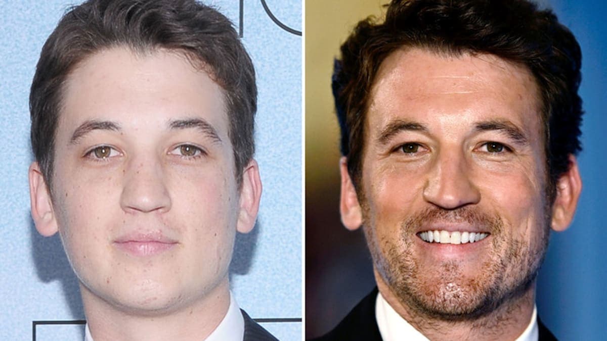 Miles Teller: Good Genes or Good Docs? The Transformation That Has Everyone Talking!