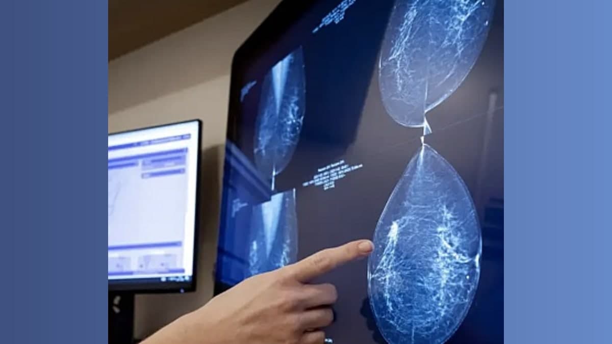 AI Breakthrough: Predicting Breast Cancer Risk—Finally, a Crystal Ball for Your Health!