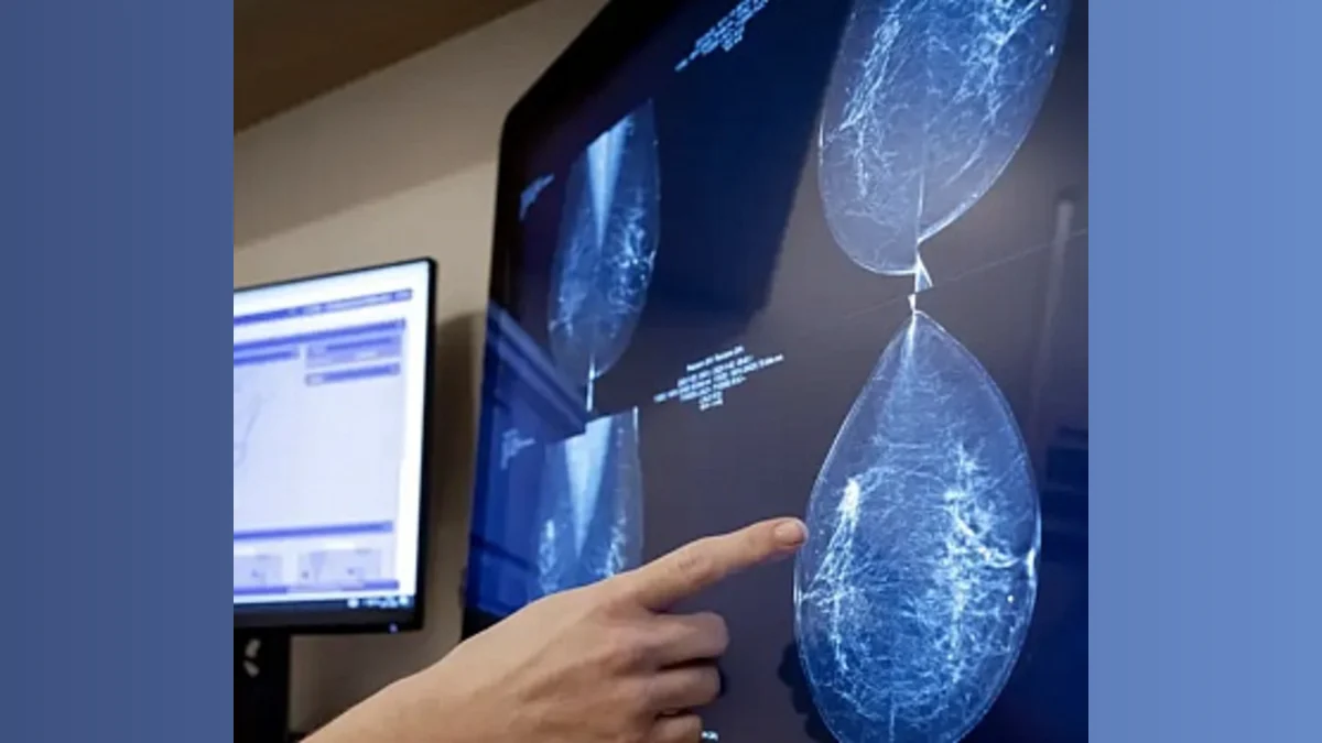 AI Breakthrough: Predicting Breast Cancer Risk—Finally, a Crystal Ball for Your Health!